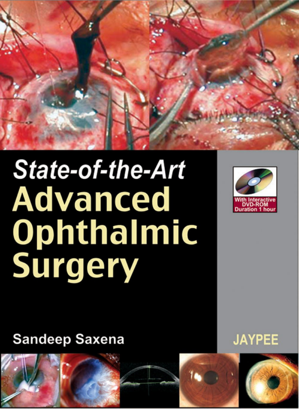 State of Art in Ophthalmic Surgery