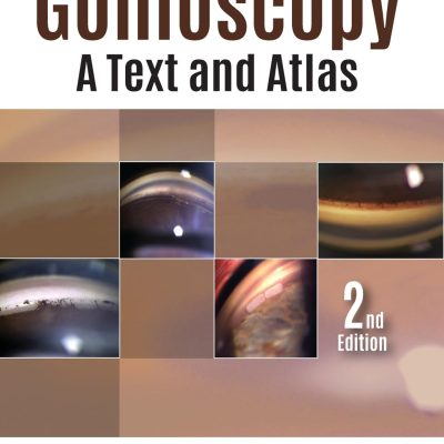 Gonioscopy