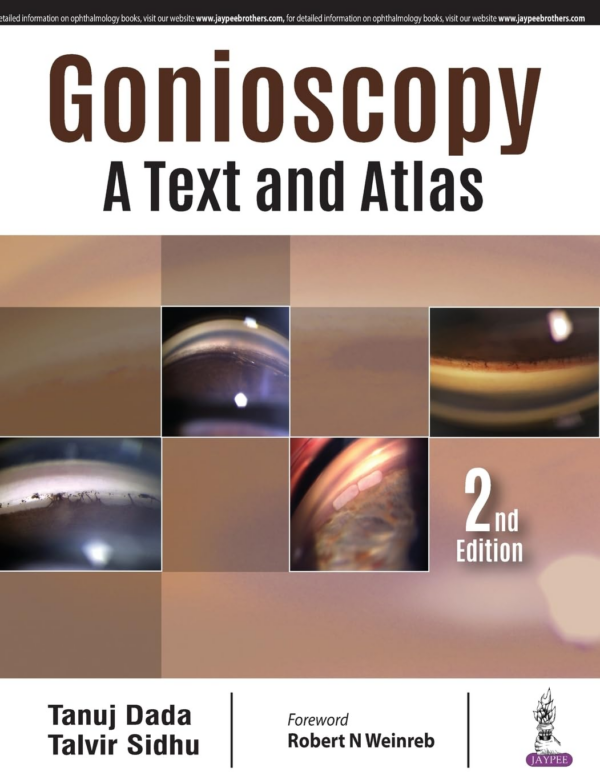 Gonioscopy