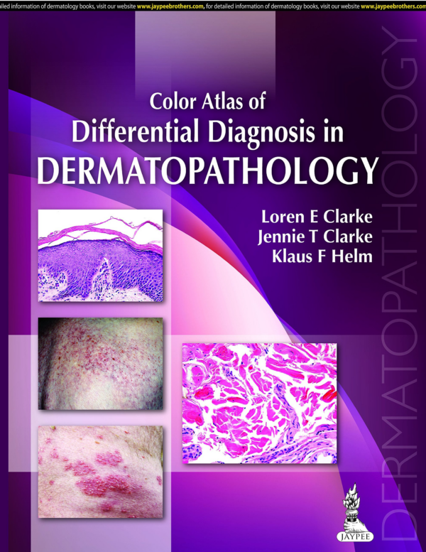 Color Atlas of Differential Diagnosis in Dermatopathology