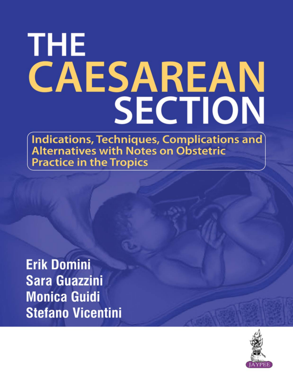 Caesarean Section