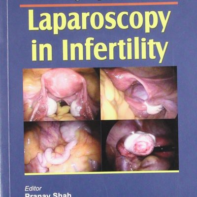 Dr Malhotra Series: Step by Step Diabetes in Pregnancy (with CD-ROM)