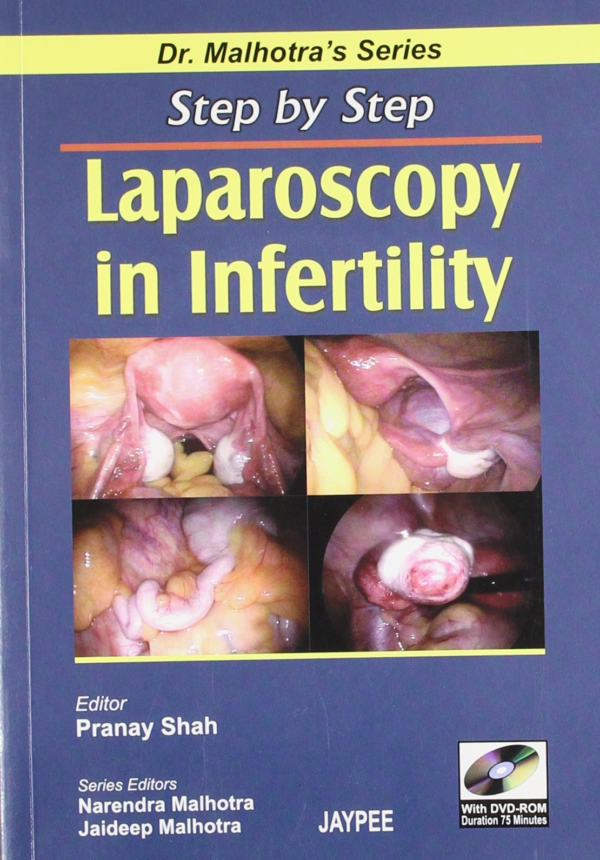 Dr Malhotra Series: Step by Step Diabetes in Pregnancy (with CD-ROM)