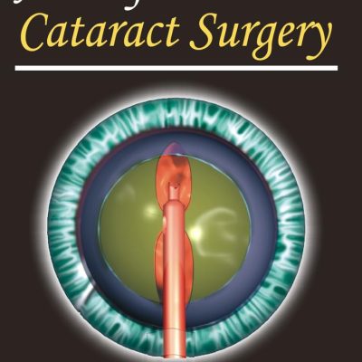 Atlas of Cataract Surgery (with DVD-ROM)