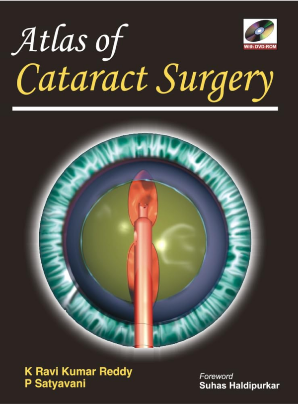 Atlas of Cataract Surgery (with DVD-ROM)