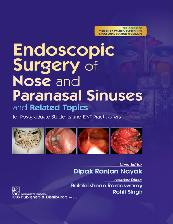 Endoscopic Surgery of Nose and Paranasal Sinuses and Related Topics