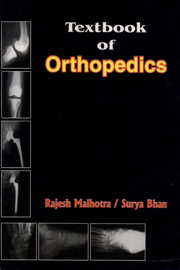 Textbook of Orthopedics