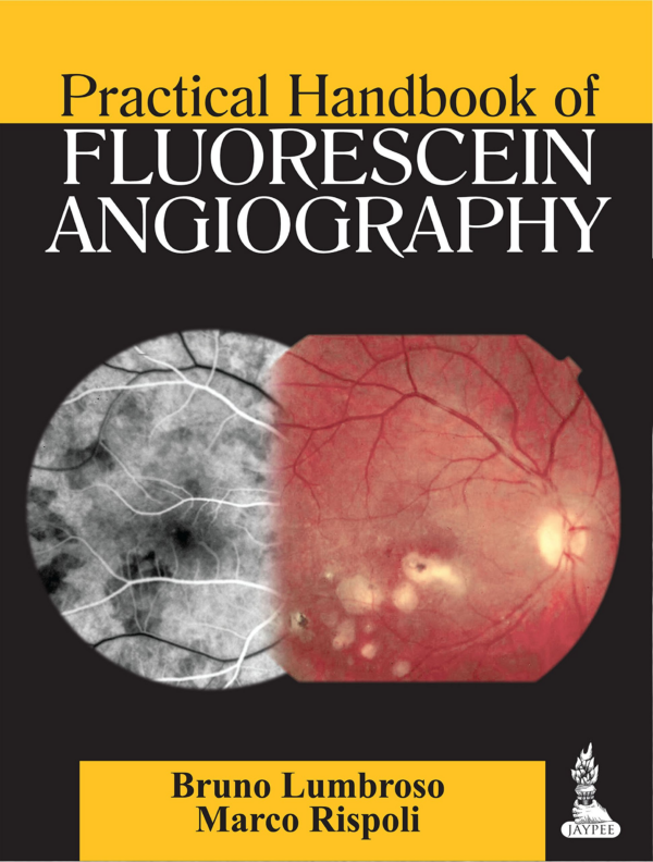 Practical Handbook of Fluorescein Angiography