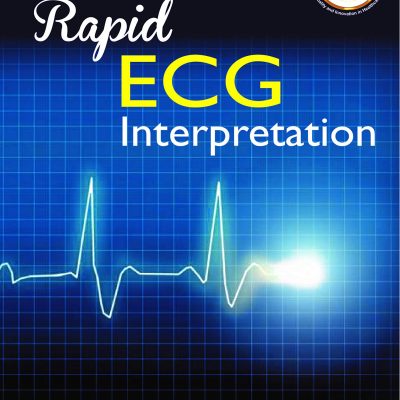 Rapid ECG Interpretation