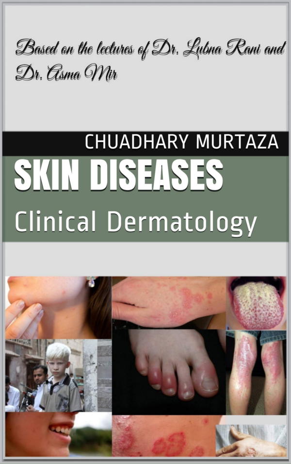 Skin Disease