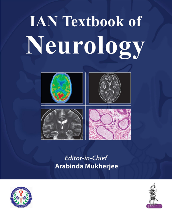 IAN Textbook of Neurology