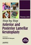 Step by Step Anterior and Posterior Lamellar Keratoplasty (with DVD-ROM)
