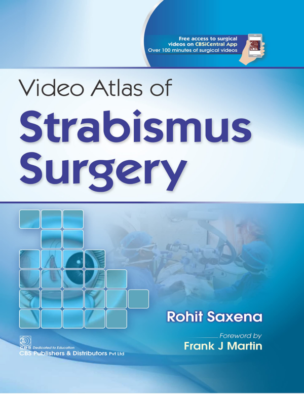 Video Atlas of Strabismus Surgery