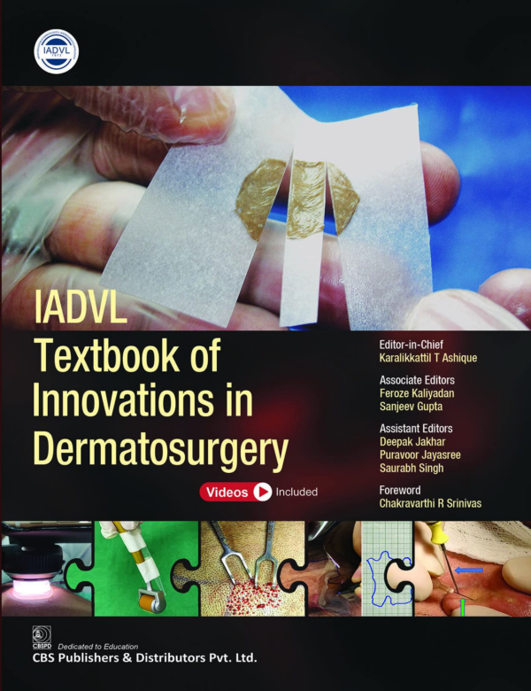 Iadvl Textbook Of Innovations In Dermatosurgery (Hb-2022)