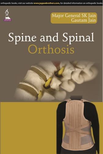 Spine and Spinal Orthosis
