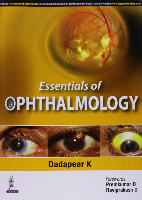 Essentials Of Ophthalmology