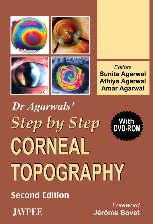 Dr Agarwal's Step by Step (R) Corneal Topography