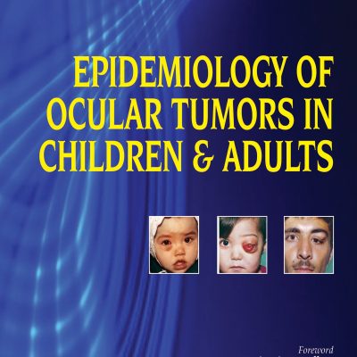 Epidemiology of Ocular Tumors in Children & Adults