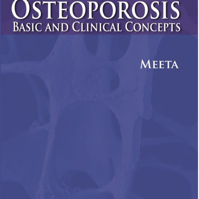 Post-Menopausal Osteoporosis