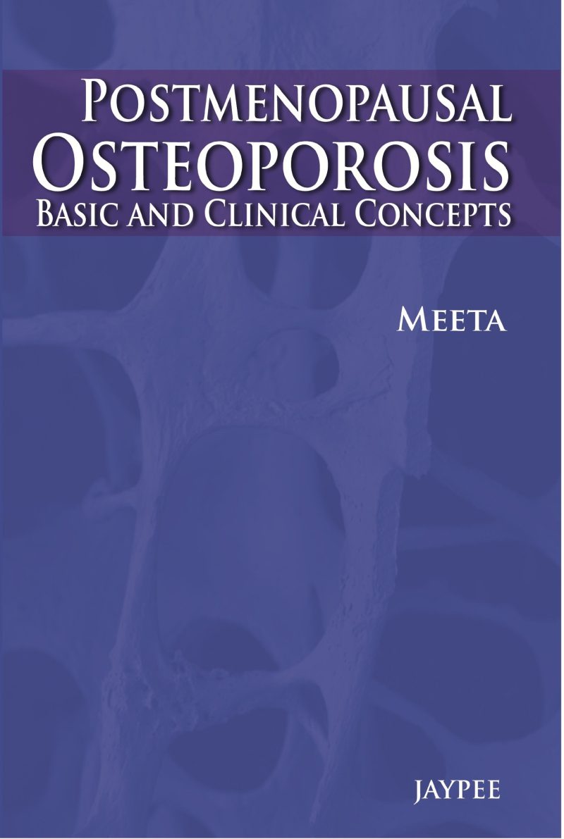 Post-Menopausal Osteoporosis