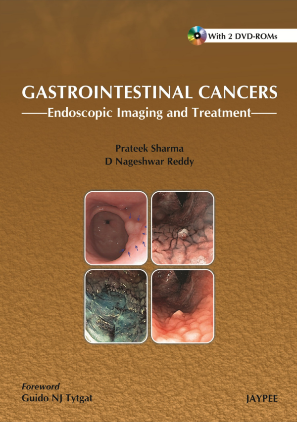 Gastrointestinal Cancers: