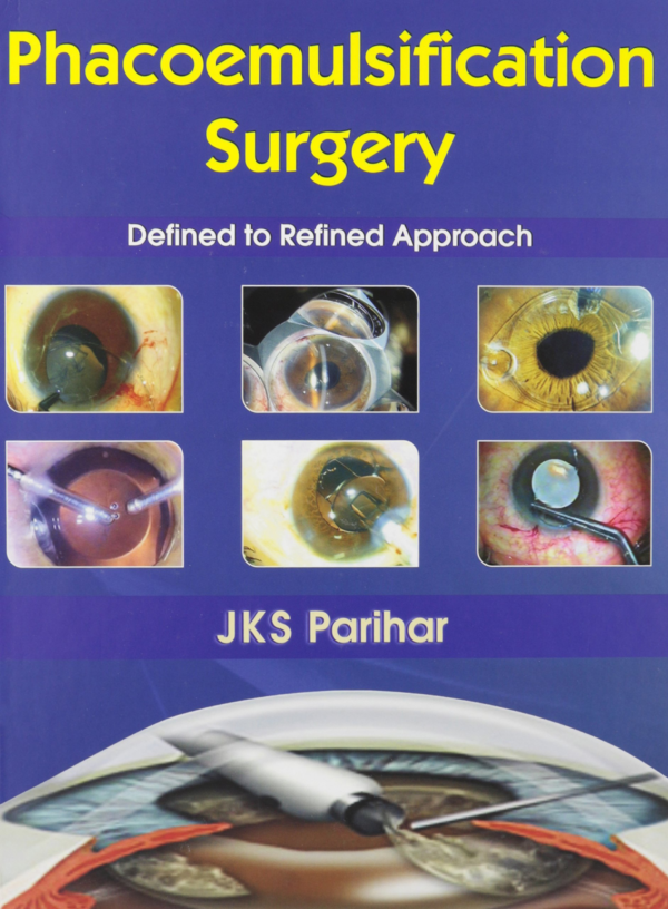Phacoemulsification Surgery