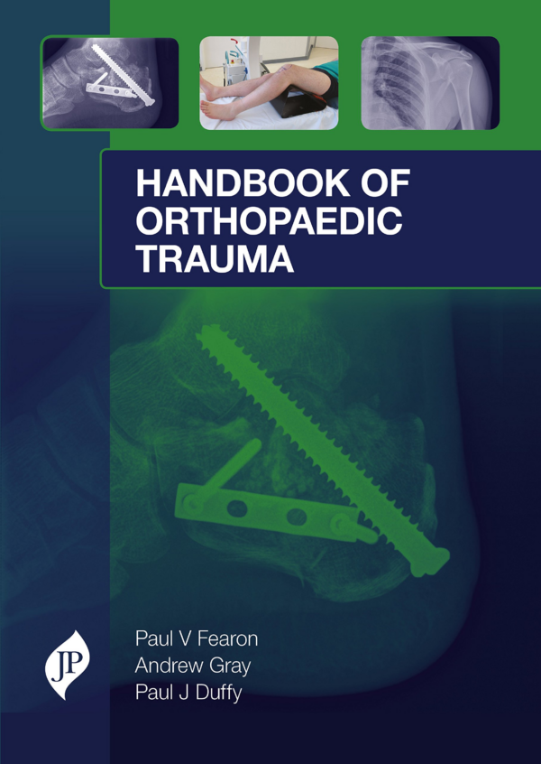 Handbook of Orthopaedic Trauma