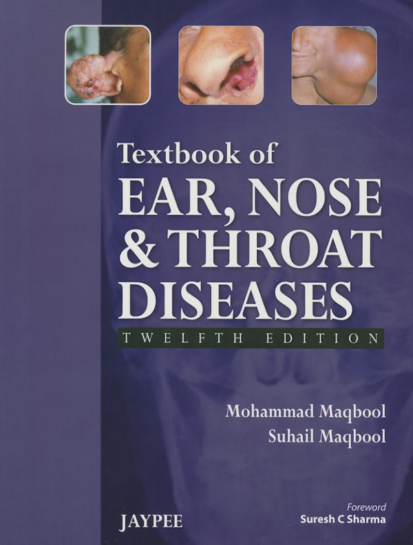Textbook of Ear, Nose and Throat