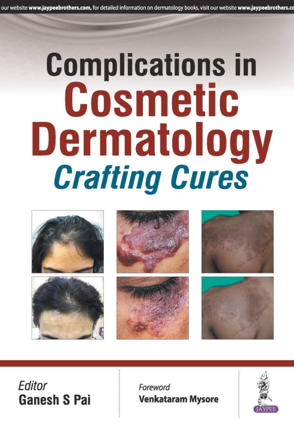 Complications in Cosmetic Dermatology