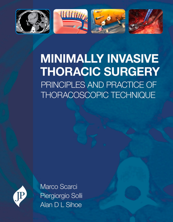 Minimally Invasive Thoracic Surgery