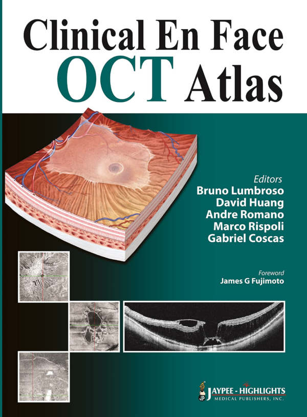 Clinical En Face OCT Atlas