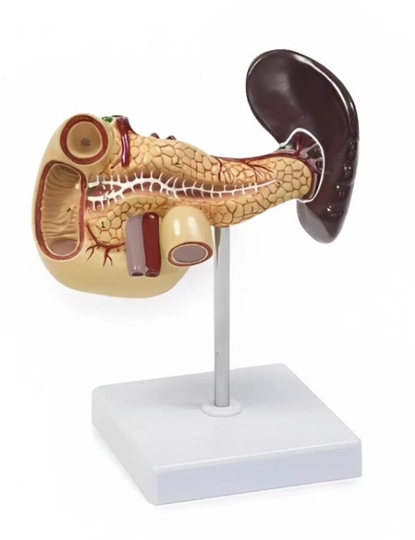 Trasplante De Rinony Pancreas, Molment I