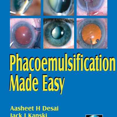 Phacoemulsification Made Easy (with 2 CD-ROMs)