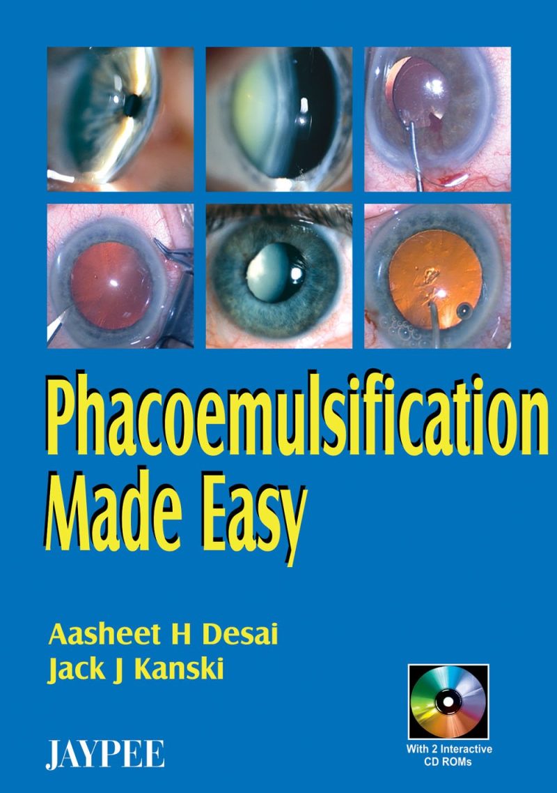 Phacoemulsification Made Easy (with 2 CD-ROMs)