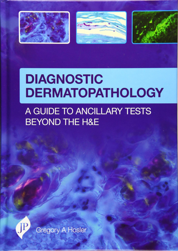 Diagnostic Dermatopathology
