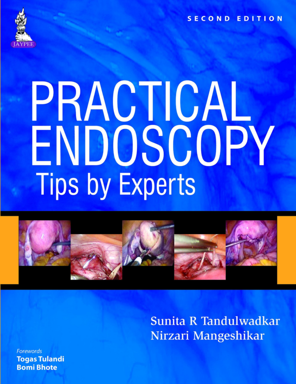 Practical Endoscopy - Tips by Experts