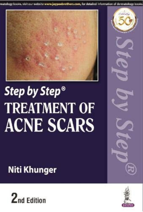 Step by Step Treatment of Acne Scars