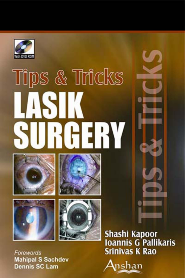 Tips & Tricks in Lasik Surgery (with DVD-ROM)