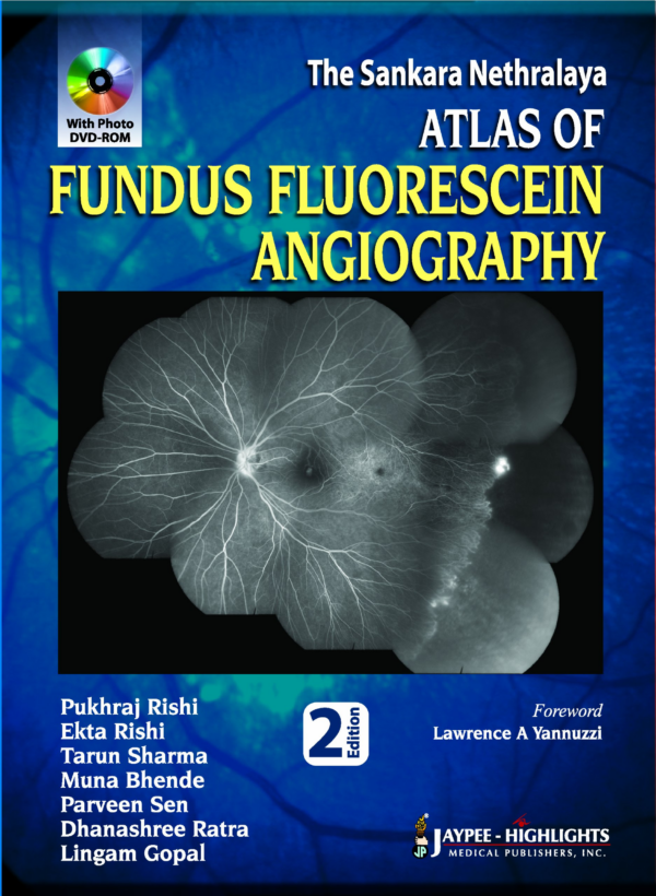 Atlas of Fundus Fluorescein Angiography