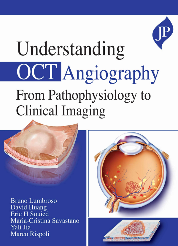 Understanding OCT Angiography