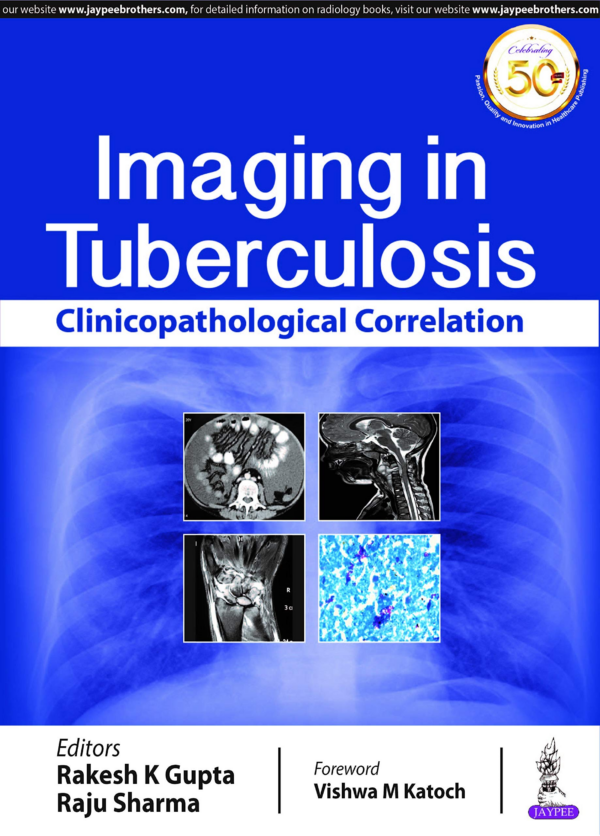 Imaging in Tuberculosis