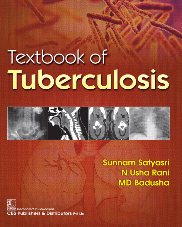TEXTBOOK OF TUBERCULOSIS (PB 2023)