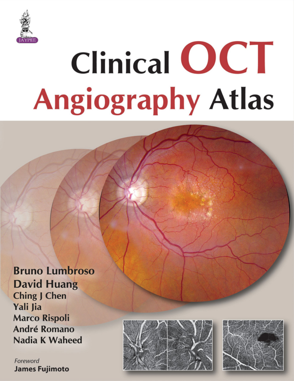 Clinical OCT Angiography Atlas