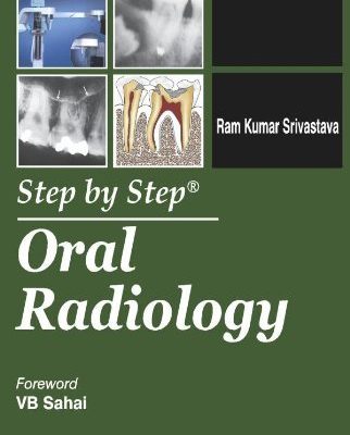 Step by Step Oral Radiology (with CD-Rom)