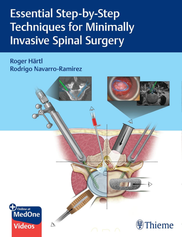 Step by Step Minimally Invasive Cataract Surgery