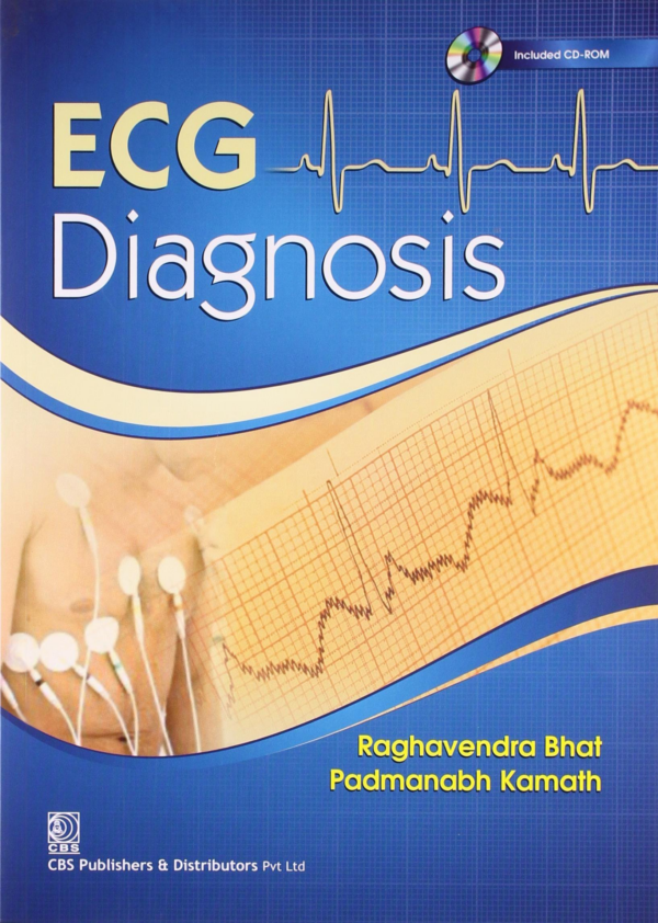 ECG Diagnosis