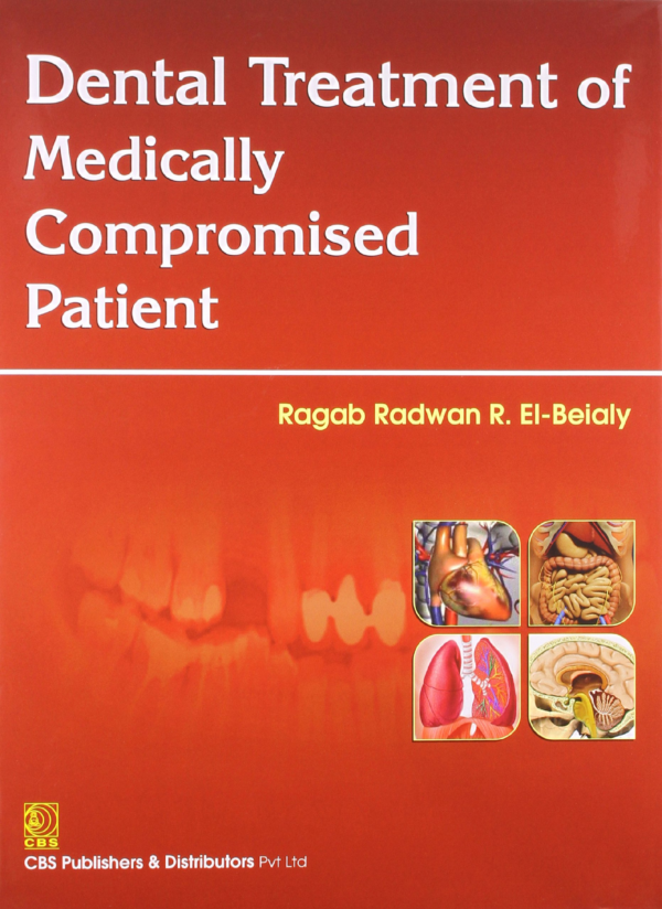 Dental Treatment of Medically Compromised Patients