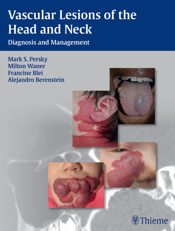 The Management of Haemangiomas and Vascular Malformations of Head and Neck
