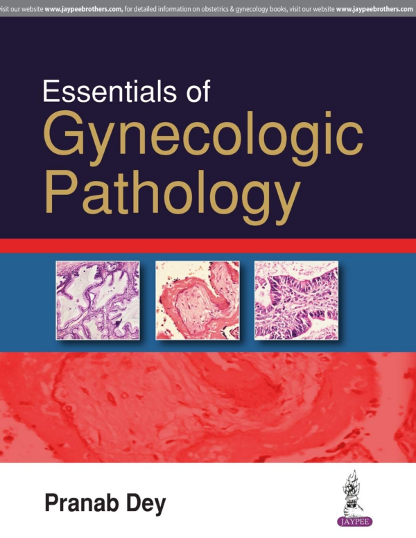 Essentials Of Gynecologic Pathology