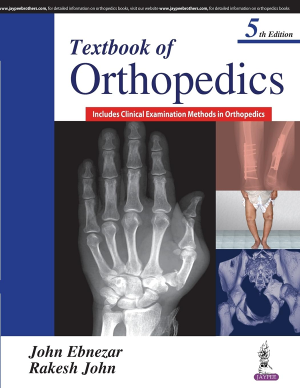 Step By Step Emergency In Orthopaedics With Photo Cd-Rom